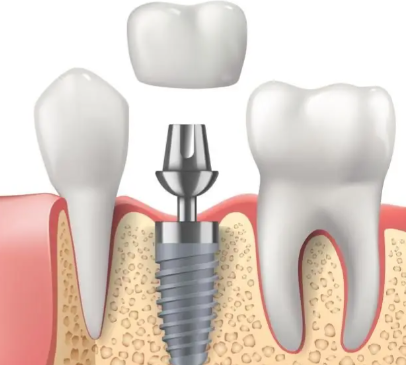 陈小丽医生口碑评价及真人实例
